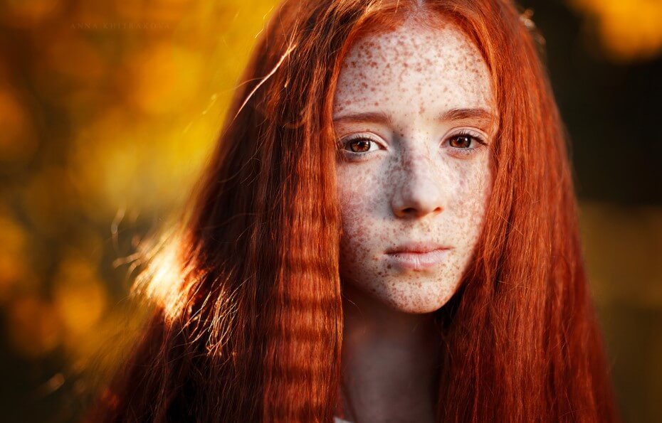 Redheads Are Mutants